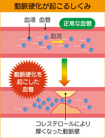 dN邵